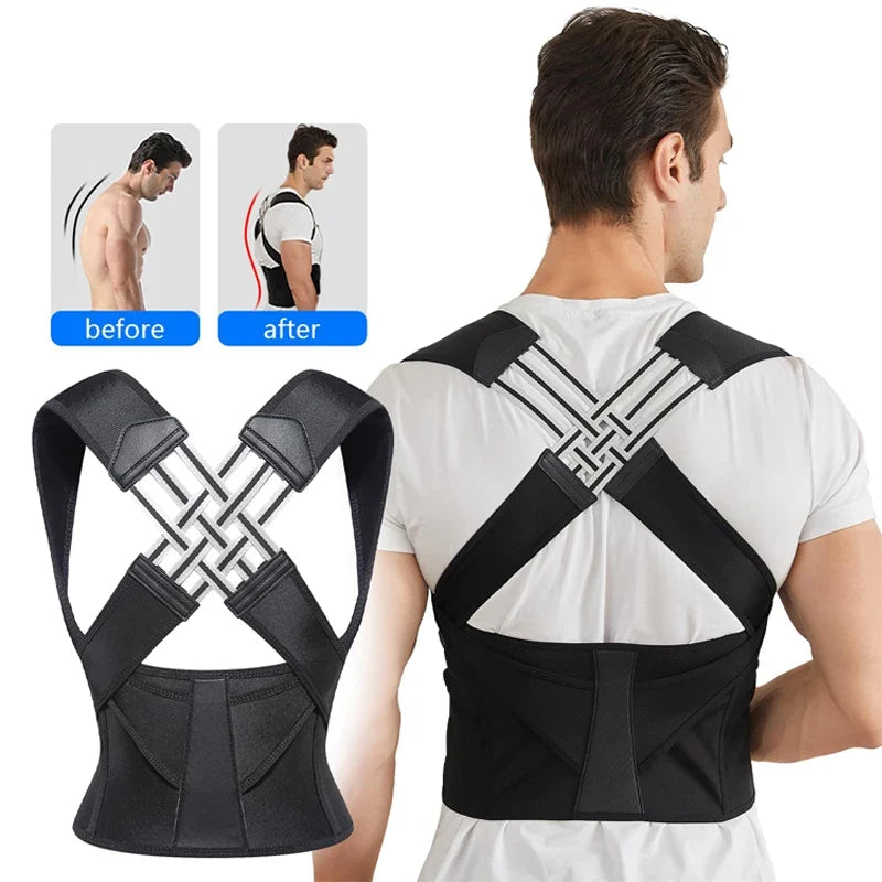 Back Posture Corrector – Shoulder & Waist Support Brace – product image 2